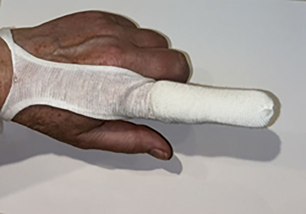 FINGERBANDAGE S